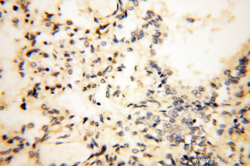 Immunohistochemistry (IHC) staining of human lung tissue using POPDC3 Polyclonal antibody (11800-1-AP)