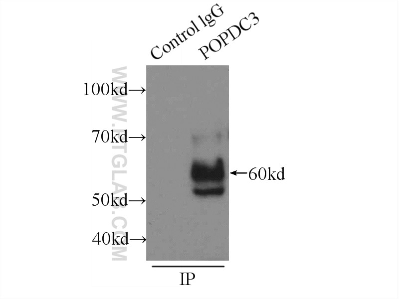 Immunoprecipitation (IP) experiment of HeLa cells using POPDC3 Polyclonal antibody (11800-1-AP)