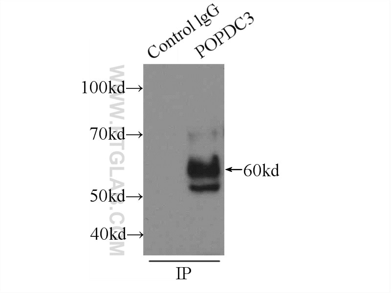 Immunoprecipitation (IP) experiment of HeLa cells using POPDC3 Polyclonal antibody (11800-1-AP)