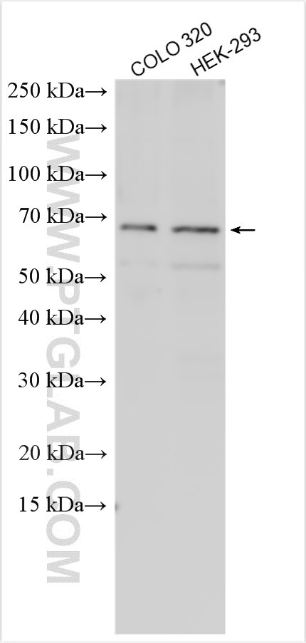 Western Blot (WB) analysis of various lysates using POPDC3 Polyclonal antibody (11800-1-AP)