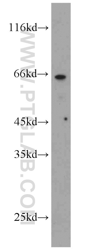 Western Blot (WB) analysis of HEK-293 cells using POPDC3 Polyclonal antibody (11800-1-AP)
