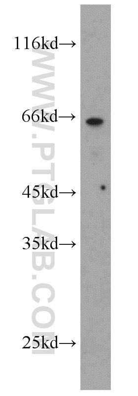 WB analysis of HEK-293 using 11800-1-AP