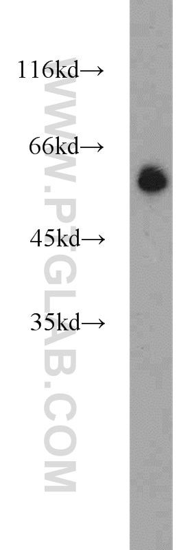 Western Blot (WB) analysis of COLO 320 cells using POPDC3 Polyclonal antibody (11800-1-AP)