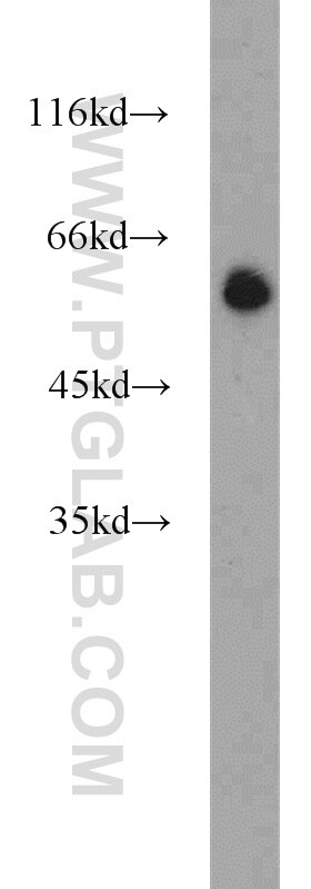 Western Blot (WB) analysis of COLO 320 cells using POPDC3 Polyclonal antibody (11800-1-AP)