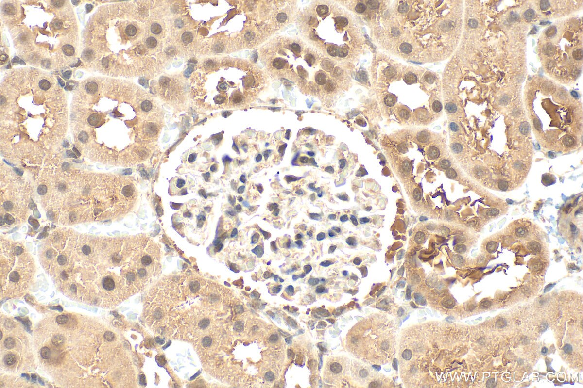 Immunohistochemistry (IHC) staining of rat kidney tissue using PORCN Polyclonal antibody (20613-1-AP)