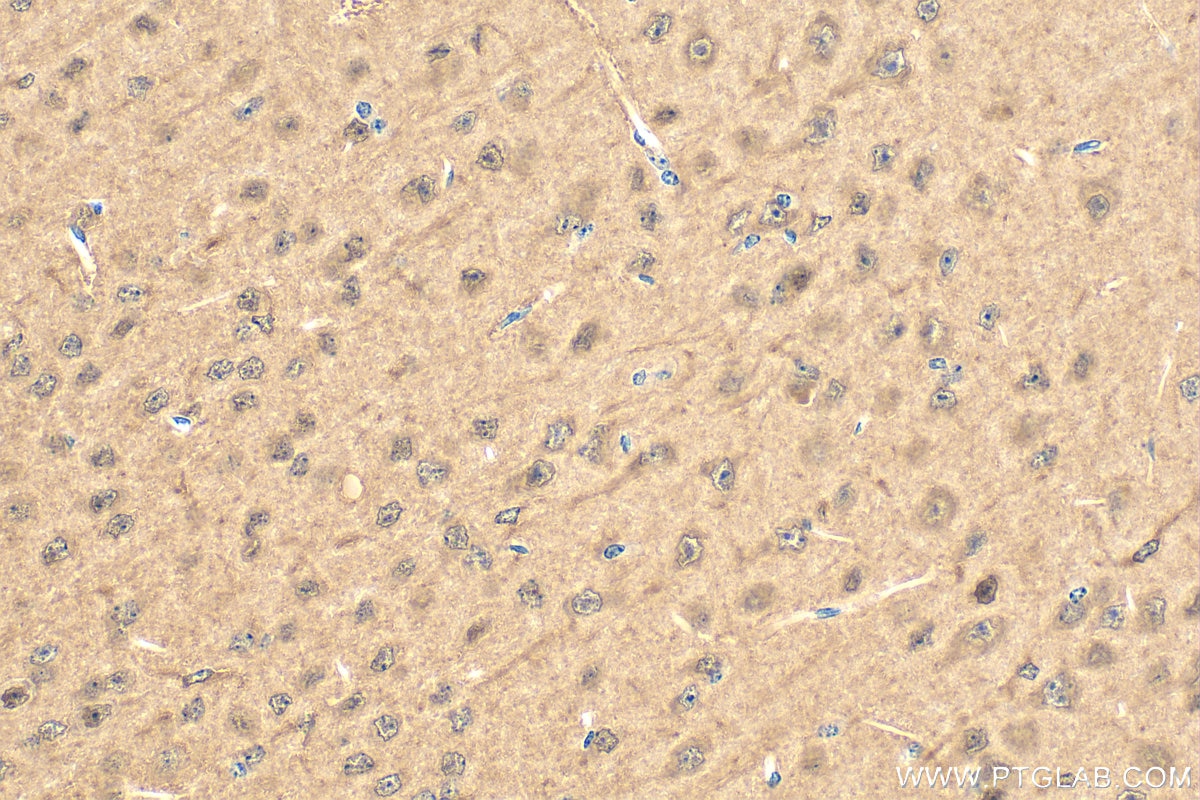 Immunohistochemistry (IHC) staining of mouse brain tissue using PORCN Polyclonal antibody (20613-1-AP)