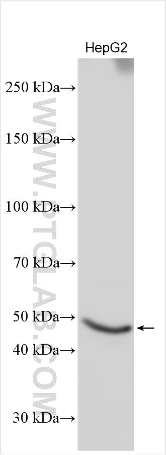 Western Blot (WB) analysis of various lysates using PORCN Polyclonal antibody (20613-1-AP)