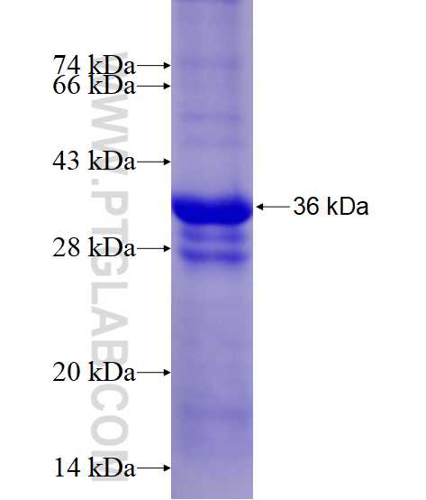 PORCN fusion protein Ag14664 SDS-PAGE