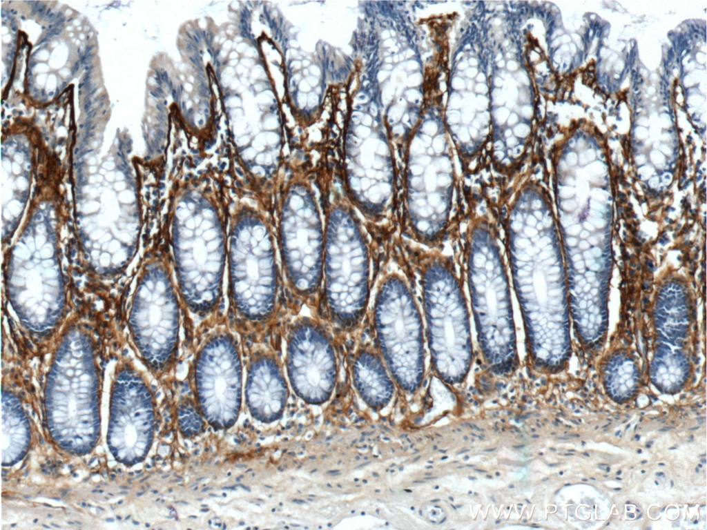 Immunohistochemistry (IHC) staining of human colon tissue using Periostin Polyclonal antibody (19899-1-AP)