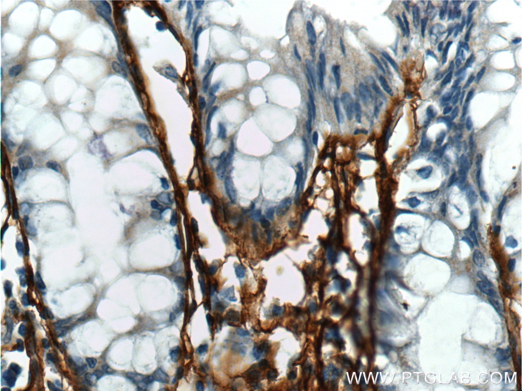 Immunohistochemistry (IHC) staining of human colon tissue using Periostin Polyclonal antibody (19899-1-AP)