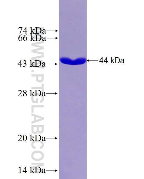 POSTN fusion protein Ag27145 SDS-PAGE