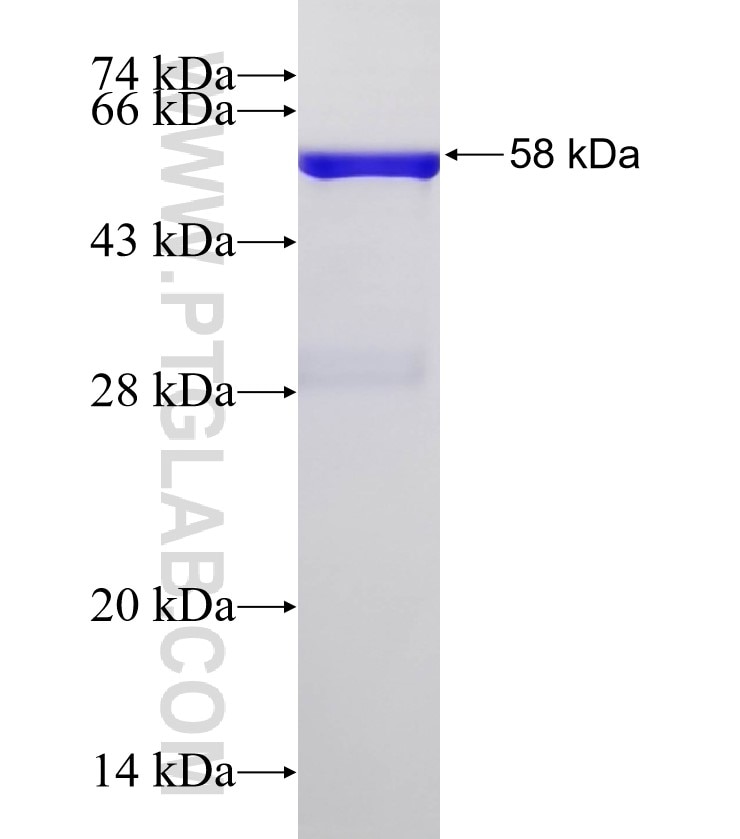 POSTN fusion protein Ag13791 SDS-PAGE