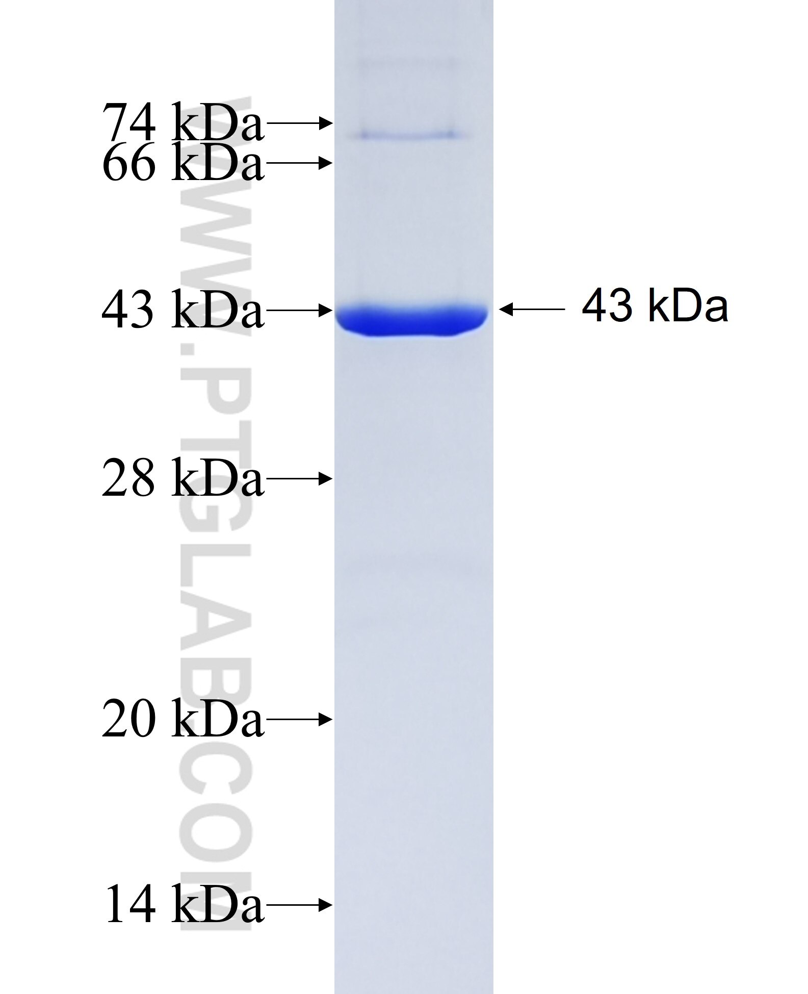 POSTN fusion protein Ag14487 SDS-PAGE