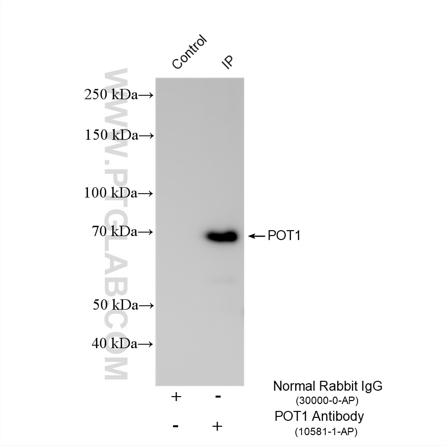 IP experiment of HeLa using 10581-1-AP Immunoprecipitation (IP) experiment of HeLa cells using POT1 Polyclonal antibody (10581-1-AP)