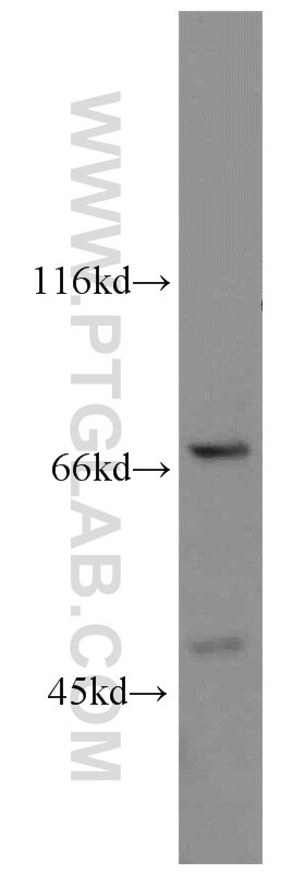 Western Blot (WB) analysis of HeLa cells using POT1 Polyclonal antibody (10581-1-AP)