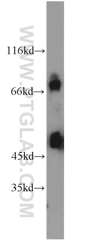 Western Blot (WB) analysis of PC-3 cells using POT1 Polyclonal antibody (10581-1-AP)