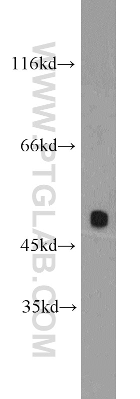 Western Blot (WB) analysis of HeLa cells using POT1 Polyclonal antibody (10581-1-AP)
