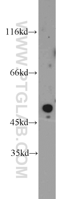 Western Blot (WB) analysis of HeLa cells using POT1 Polyclonal antibody (10581-1-AP)