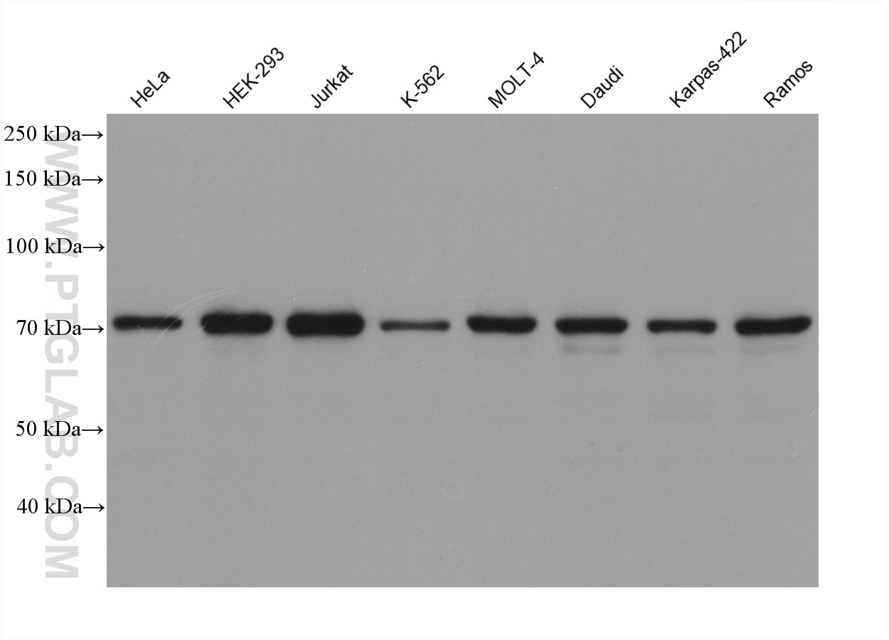 Western Blot (WB) analysis of various lysates using POT1 Monoclonal antibody (60556-7-Ig)
