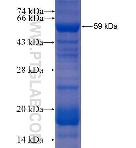 POT1 fusion protein Ag0875 SDS-PAGE