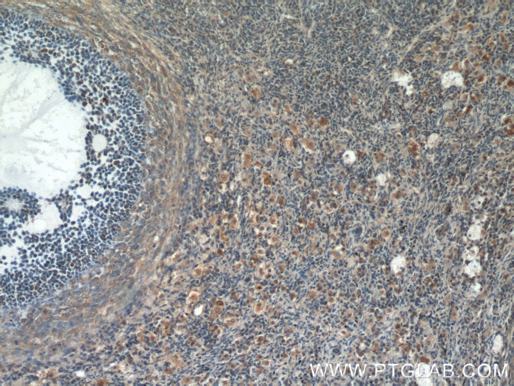 Immunohistochemistry (IHC) staining of human ovary tissue using POTEA Polyclonal antibody (24593-1-AP)