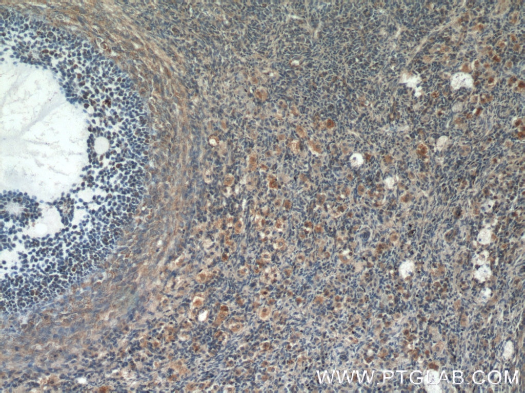 IHC staining of human ovary using 24593-1-AP