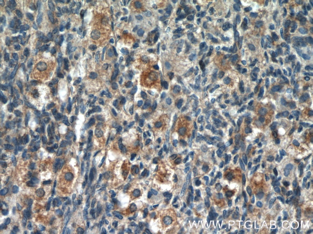 Immunohistochemistry (IHC) staining of human ovary tissue using POTEA Polyclonal antibody (24593-1-AP)