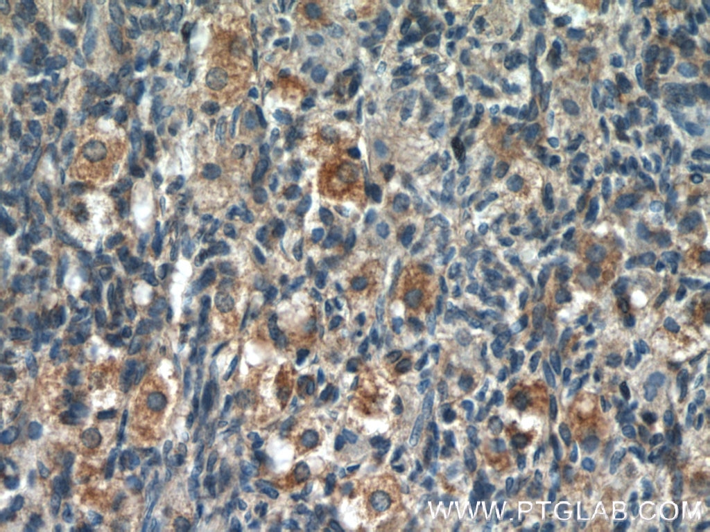 IHC staining of human ovary using 24593-1-AP