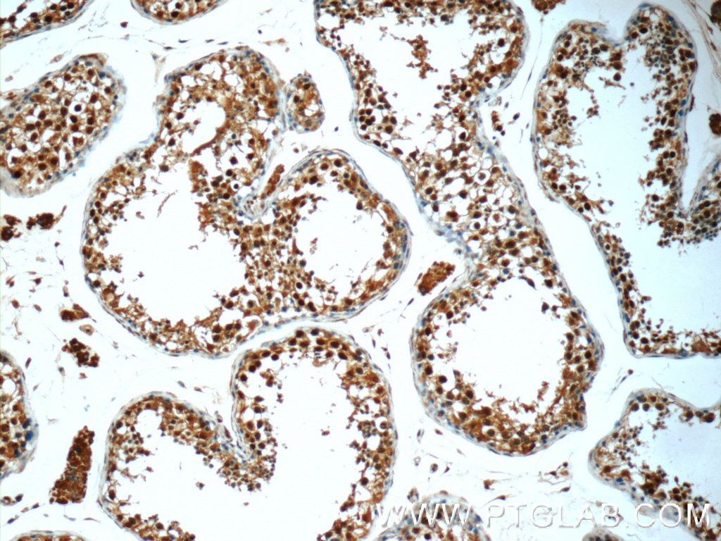 IHC staining of human testis using 24593-1-AP