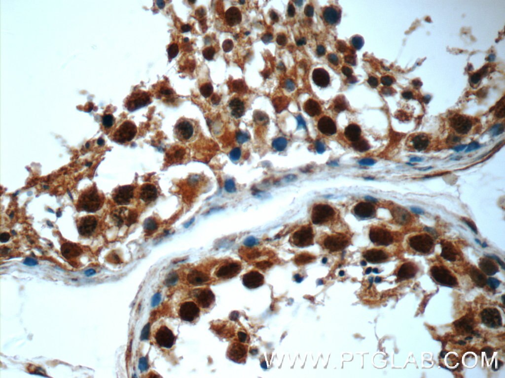Immunohistochemistry (IHC) staining of human testis tissue using POTEA Polyclonal antibody (24593-1-AP)