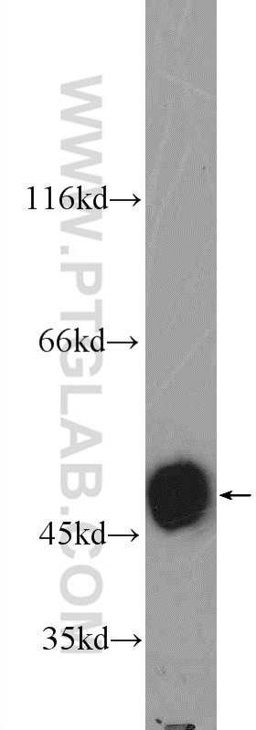 Western Blot (WB) analysis of mouse skeletal muscle tissue using POTEA Polyclonal antibody (24593-1-AP)