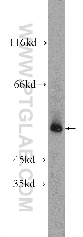 Western Blot (WB) analysis of human testis tissue using POTEA Polyclonal antibody (24593-1-AP)