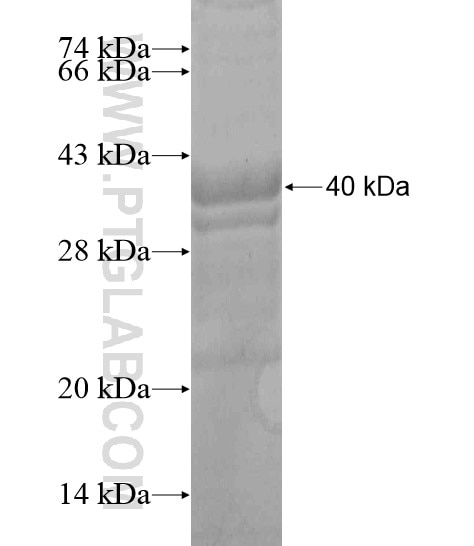 POTEA fusion protein Ag20188 SDS-PAGE