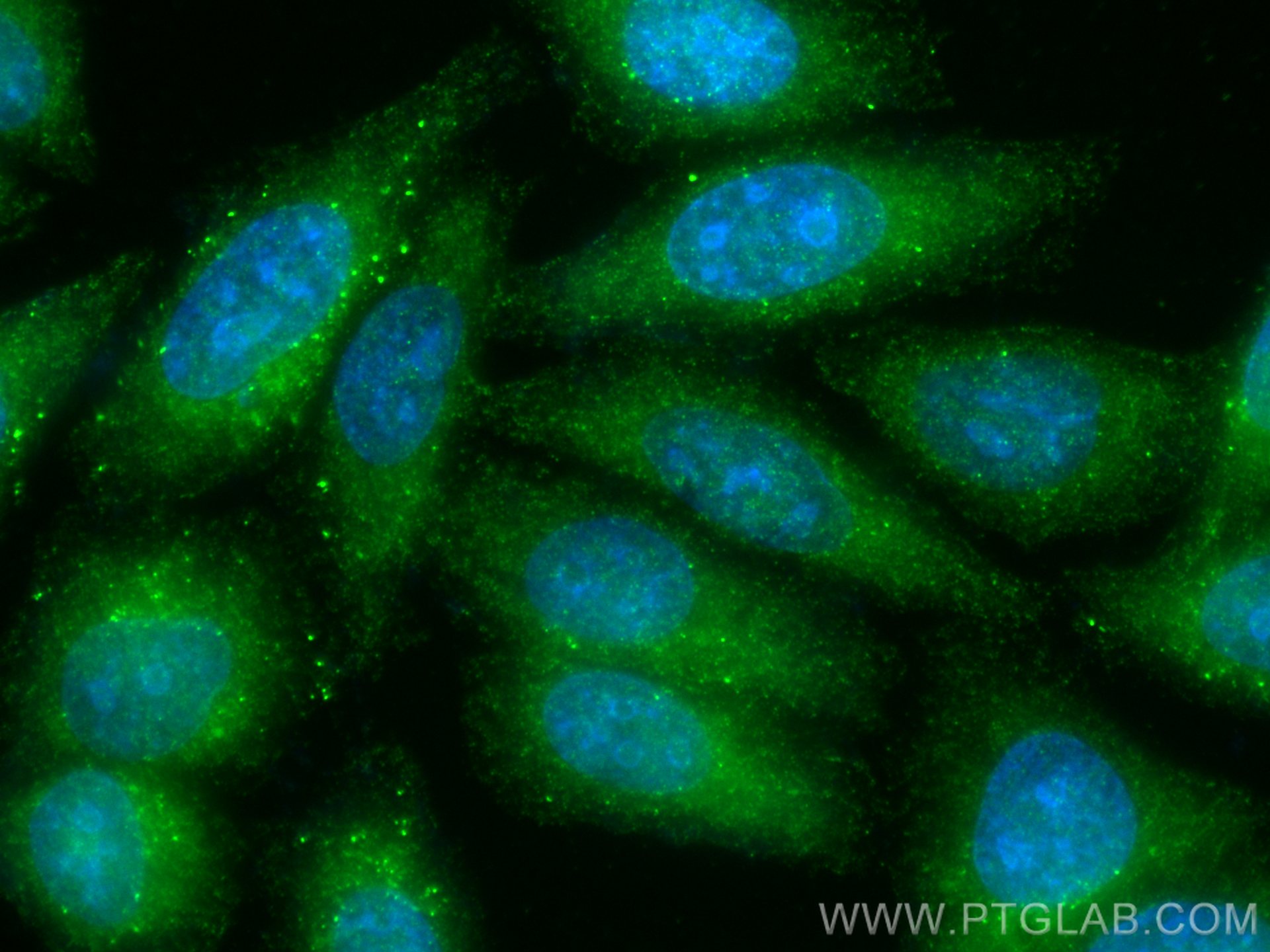 Immunofluorescence (IF) / fluorescent staining of HepG2 cells using POTEA-Specific Polyclonal antibody (20203-1-AP)