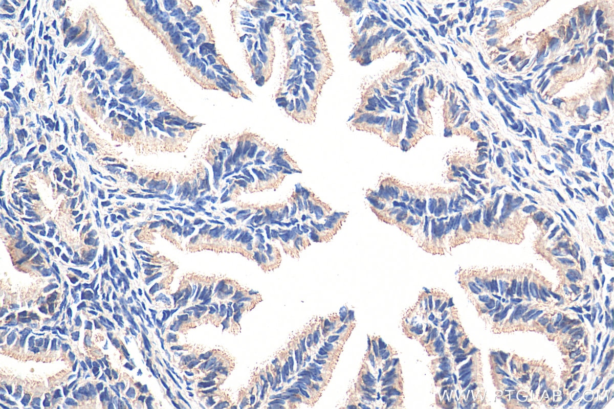 Immunohistochemistry (IHC) staining of mouse ovary tissue using POTEA-Specific Polyclonal antibody (20203-1-AP)
