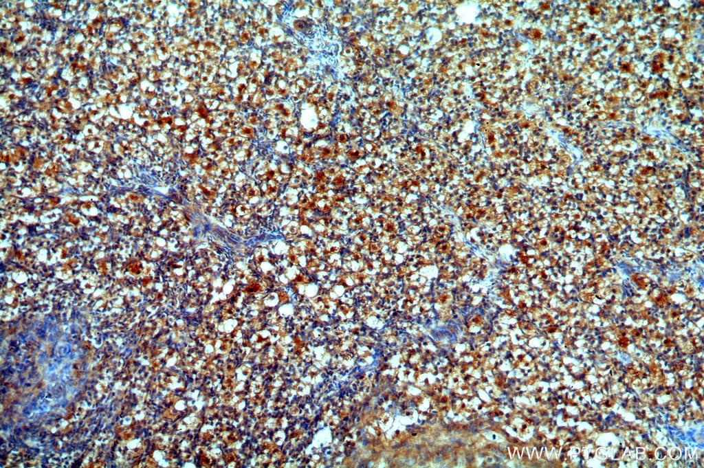 Immunohistochemistry (IHC) staining of human ovary tissue using POTEA-Specific Polyclonal antibody (20203-1-AP)