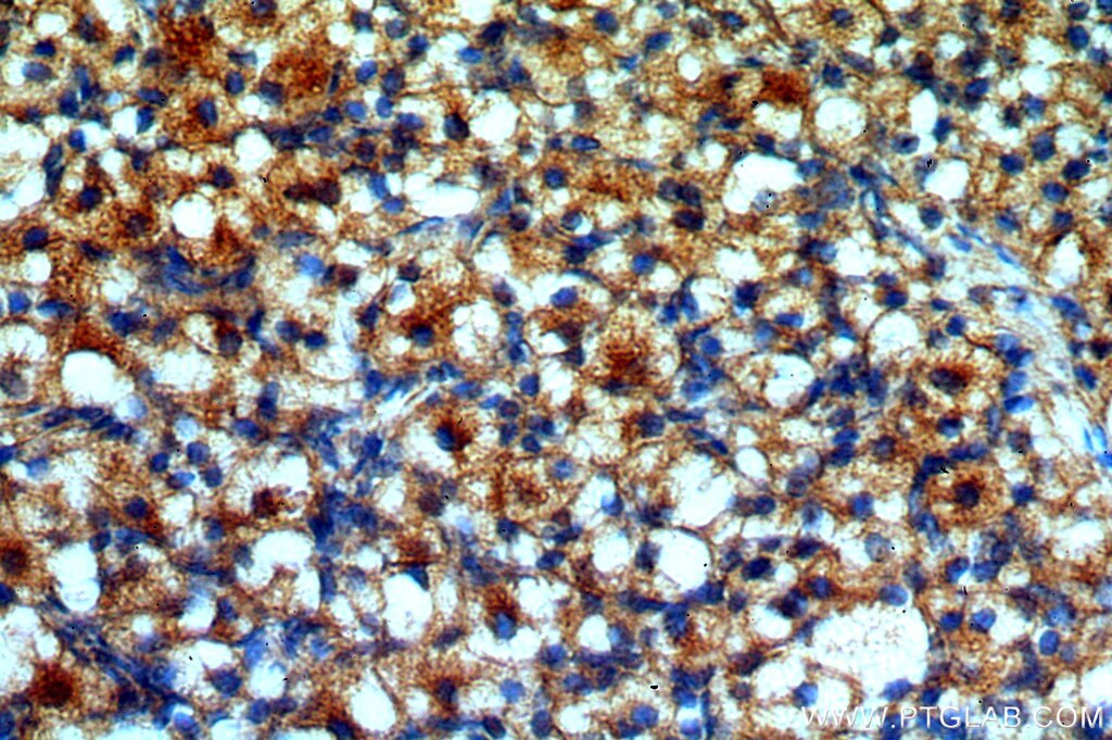 Immunohistochemistry (IHC) staining of human ovary tissue using POTEA-Specific Polyclonal antibody (20203-1-AP)