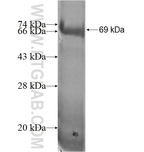POTEB fusion protein Ag5368 SDS-PAGE