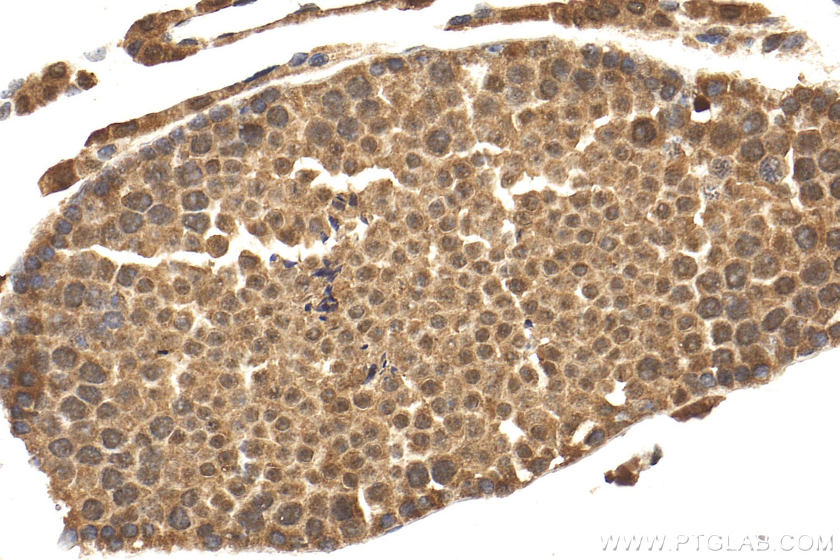 Immunohistochemistry (IHC) staining of mouse testis tissue using POTEB-Specific Polyclonal antibody (20205-1-AP)