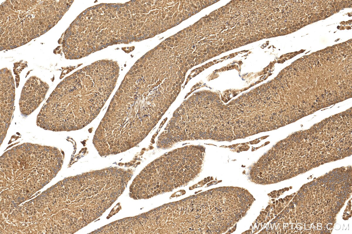 Immunohistochemistry (IHC) staining of mouse testis tissue using POTEB-Specific Polyclonal antibody (20205-1-AP)