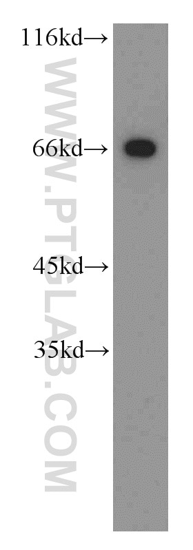 Western Blot (WB) analysis of mouse testis tissue using POTED-Specific Polyclonal antibody (20206-1-AP)