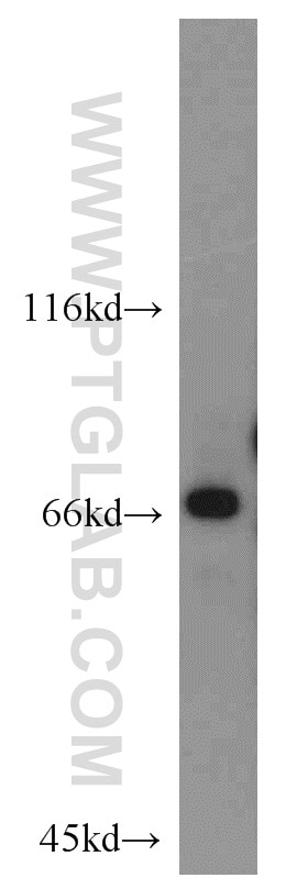 Western Blot (WB) analysis of mouse testis tissue using POTED-Specific Polyclonal antibody (20206-1-AP)