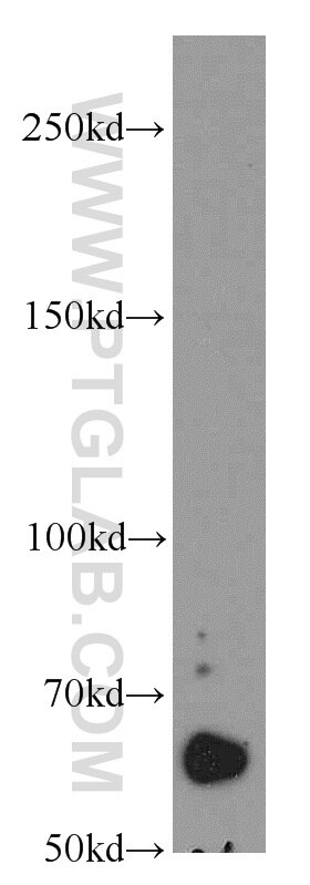 Western Blot (WB) analysis of mouse ovary tissue using POTED-Specific Polyclonal antibody (20206-1-AP)