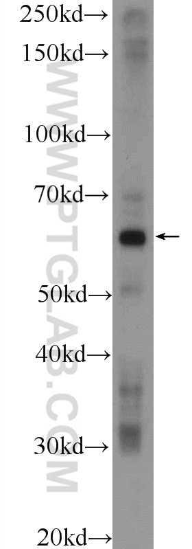 Western Blot (WB) analysis of DU 145 cells using POTEH Polyclonal antibody (24837-1-AP)