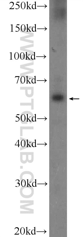 Western Blot (WB) analysis of DU 145 cells using POTEH Polyclonal antibody (24837-1-AP)
