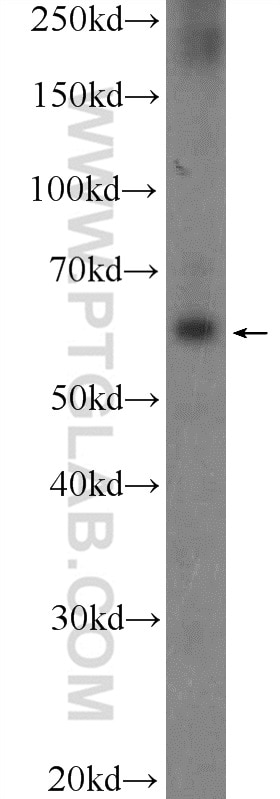 Western Blot (WB) analysis of DU 145 cells using POTEH Polyclonal antibody (24837-1-AP)