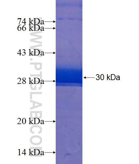 POTEH fusion protein Ag20275 SDS-PAGE