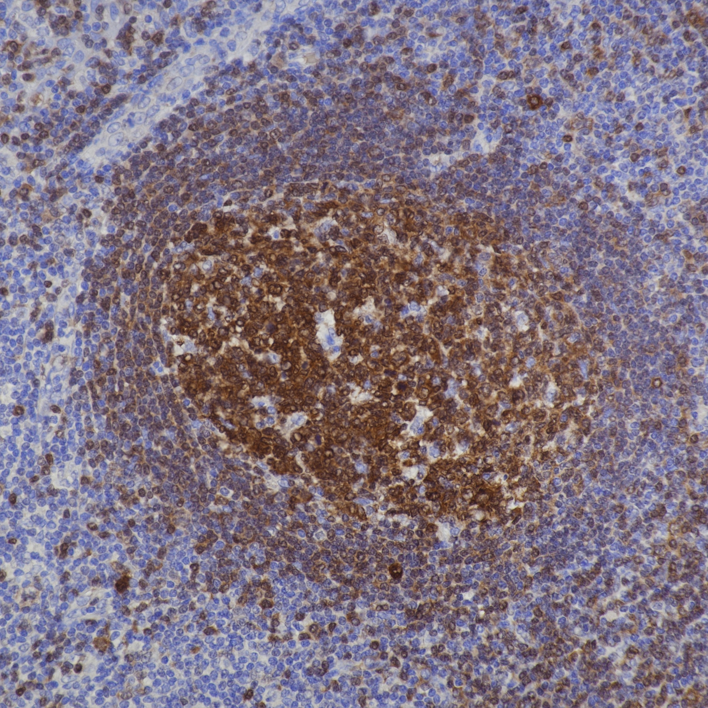 IHC staining of human tonsil using 66659-1-Ig Immunohistochemistry (IHC) staining of human tonsil tissue using POU2AF1 Monoclonal antibody (66659-1-Ig)