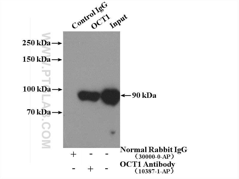 Immunoprecipitation (IP) experiment of HeLa cells using OCT1 Polyclonal antibody (10387-1-AP)