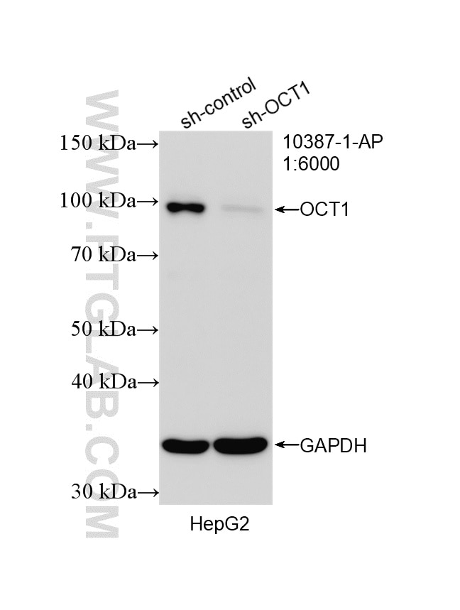 Western Blot (WB) analysis of HepG2 cells using OCT1 Polyclonal antibody (10387-1-AP)